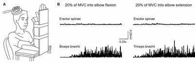 Crossed Corticospinal Facilitation Between Arm and Trunk Muscles Correlates With Trunk Control After Spinal Cord Injury